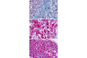 Immunohistochemical staining of formalin-fixed paraffin-embedded human tonsil (A), adrenal gland (B) and testis (C) with CELSR1 polyclonal antibody .