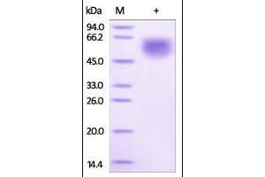 IL1RL1 Protein (AA 19-328) (His tag)