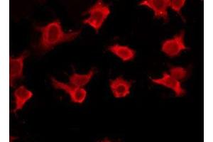 ABIN6277419 staining HepG2 by IF/ICC. (P2RY11 antibody)