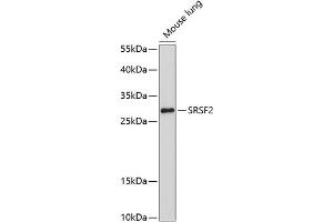 Western blot analysis of extracts of mouse lung, using SRSF2 antibody (ABIN1682677, ABIN3017915, ABIN3017916, ABIN5664377 and ABIN6220303) at 1:1000 dilution.