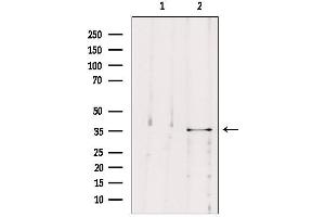 Western blot analysis of extracts from B16F10, using MAST4 Antibody.