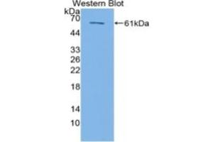 Western Blotting (WB) image for Heat Shock 60kDa Protein 1 (Chaperonin) (HSPD1) ELISA Kit (ABIN6574223)