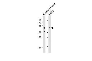 All lanes : Anti-KIST Antibody  at 1:1000 dilution Lane 1: human skeletal muscle lysate Lane 2: A-673 whole cell lysate Lysates/proteins at 20 μg per lane. (UHMK1 antibody  (C-Term))
