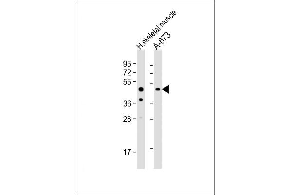 UHMK1 antibody  (C-Term)