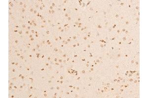 Immunohistochemistry (IHC) image for anti-Nuclear Factor of kappa Light Polypeptide Gene Enhancer in B-Cells Inhibitor, alpha (NFKBIA) (pSer32), (pSer36) antibody (ABIN6256292)