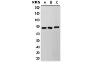 Western blot analysis of NDUFS1 expression in HeLa (A), SP2/0 (B), PC12 (C) whole cell lysates. (NDUFS1 antibody  (C-Term))