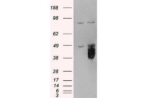 Western Blotting (WB) image for Tissue Factor Pathway Inhibitor (Lipoprotein-Associated Coagulation Inhibitor) (TFPI) peptide (ABIN370020) (Tissue Factor Pathway Inhibitor (Lipoprotein-Associated Coagulation Inhibitor) (TFPI) Peptide)