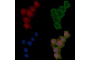 ABIN6255486 and ABIN6277780 staining Hela cells(30 min of UV treatment) by IF/ICC. (PKC epsilon antibody  (pSer729))
