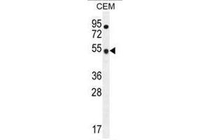 Western blot analysis using TBC1D13 Antibody (Center) Cat. (TBC1D13 antibody  (Middle Region))