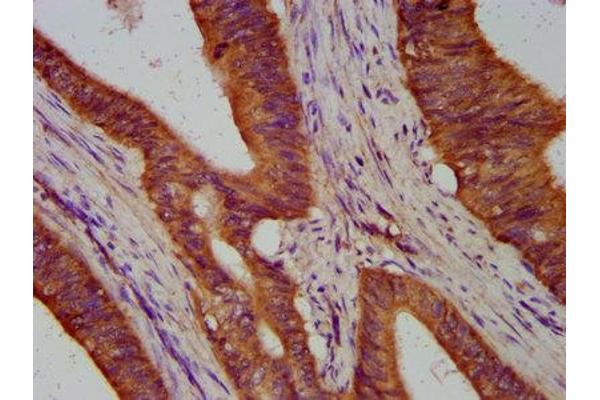 TIMELESS antibody  (AA 1004-1131)