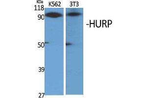 Western Blot (WB) analysis of specific cells using HURP Polyclonal Antibody. (DLGAP5 antibody  (C-Term))