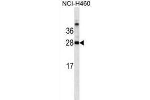 Western Blotting (WB) image for anti-Galectin 3 (LGALS3) antibody (ABIN2995387) (Galectin 3 antibody)