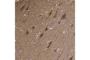Immunohistochemical staining of human cerebral cortex with YWHAQ polyclonal antibody  shows strong cytoplasmic positivity in neuronal cells and glial cells.