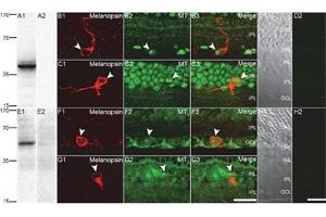 Expression of MT1 and MT2 receptors in rat retina.