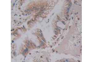Used in DAB staining on fromalin fixed paraffin- embedded Kidney tissue (Phospholipase C beta 3, Phosphoinositide Specific (AA 318-468) antibody)