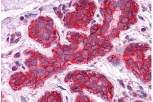 Human Breast: Formalin-Fixed, Paraffin-Embedded (FFPE) (JUP antibody  (AA 1-746))