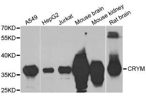 Western Blotting (WB) image for anti-Crystallin, mu (CRYM) (AA 1-314) antibody (ABIN1679371) (CRYM antibody  (AA 1-314))