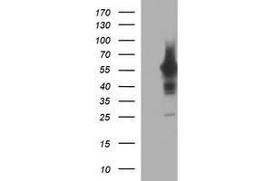 Image no. 1 for anti-Tyrosine Hydroxylase (TH) antibody (ABIN1501369) (Tyrosine Hydroxylase antibody)