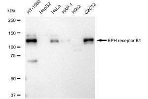Western blotting analysis using EPH receptor B1 antibody (ABIN7798455). (Recombinant EPH Receptor B1 antibody)