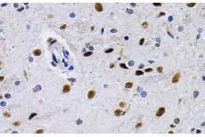 Immunohistochemistry of paraffin-embedded Rat brain using ID3 Polyclonal Antibody at dilution of 1:200 (40x lens). (ID3 antibody)