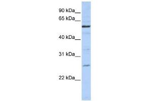 Western Blotting (WB) image for anti-Zinc Finger, CCCH-Type with G Patch Domain (ZGPAT) (C-Term) antibody (ABIN632083)