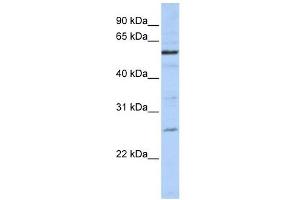 ZGPAT antibody used at 1 ug/ml to detect target protein. (ZGPAT antibody  (C-Term))