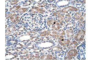 IFI44L antibody was used for immunohistochemistry at a concentration of 4-8 ug/ml to stain Epithelial cells of renal tubule (arrows) in Human Kidney.