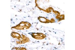 Immunohistochemistry of paraffin embedded mouse skin using Annexin-A8 (ABIN7073071) at dilution of 1: 1600 (400x lens) (Annexin VIII antibody)