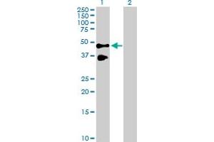 Western Blot analysis of TNFRSF10B expression in transfected 293T cell line by TNFRSF10B MaxPab polyclonal antibody.
