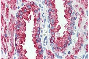 Prostate, Human: Formalin-Fixed, Paraffin-Embedded (FFPE) (GPR146 antibody  (Internal Region))