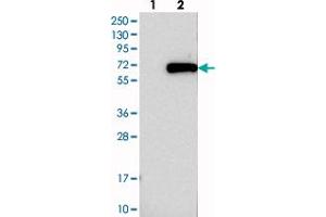 Western blot analysis of Lane 1: Negative control (vector only transfected HEK293T lysate), Lane 2: Over-expression Lysate (Co-expressed with a C-terminal myc-DDK tag (~3. (TRMT61B antibody)