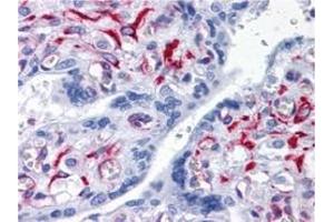 Immunohistochemistry (IHC) image for anti-Solute Carrier Family 44, Member 2 (SLC44A2) (AA 123-231) antibody (ABIN614725) (SLC44A2 antibody  (AA 123-231))