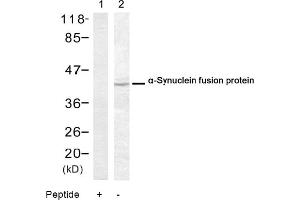 Image no. 1 for anti-Synuclein, alpha (SNCA) (Ser129) antibody (ABIN319324) (SNCA antibody  (Ser129))