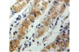 Used in DAB staining on fromalin fixed paraffin-embedded Stomach tissue (CXCL17 antibody  (AA 24-119))