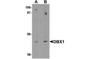Western blot analysis of DBX1 in mouse kidney tissue lysate with DBX1 antibody at (A) 1 and (B) 2 μg/mL. (DBX1 antibody  (Middle Region))
