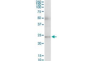 RAB23 MaxPab polyclonal antibody. (RAB23 antibody  (AA 1-237))