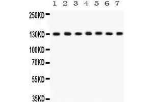 Western Blotting (WB) image for anti-Discs, Large Homolog 1 (DLG1) (AA 1-165) antibody (ABIN3043562) (DLG1 antibody  (AA 1-165))