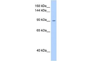 WB Suggested Anti-OSMR Antibody Titration:  0. (Oncostatin M Receptor antibody  (N-Term))