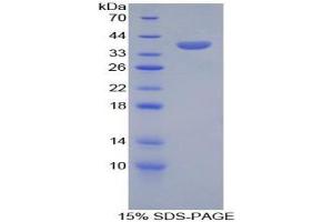 SDS-PAGE analysis of Human SPINK1 Protein. (SPINK1 Protein)