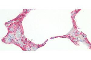 Immunohistochemistry (IHC) image for anti-Caveolin 1, Caveolae Protein, 22kDa (CAV1) (AA 2-105) antibody (ABIN7431326)