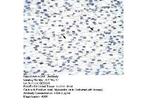 Rabbit Anti-ADAT1 Antibody  Paraffin Embedded Tissue: Human Heart Cellular Data: Myocardial cells Antibody Concentration: 4. (ADAT1 antibody  (C-Term))