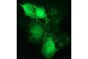 Anti-CTNNB1 mouse monoclonal antibody (ABIN2454138) immunofluorescent staining of COS7 cells transiently transfected by pCMV6-ENTRY CTNNB1 (RC208947). (CTNNB1 antibody)