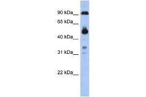 WB Suggested Anti-CCDC144B Antibody Titration: 0. (CCDC144B antibody  (Middle Region))