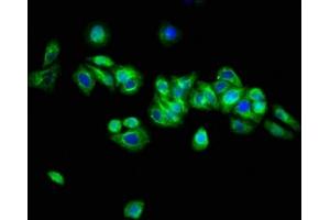Immunofluorescence staining of HepG2 cells with ABIN7144697 at 1:133, counter-stained with DAPI. (Arylsulfatase H antibody  (AA 449-529))