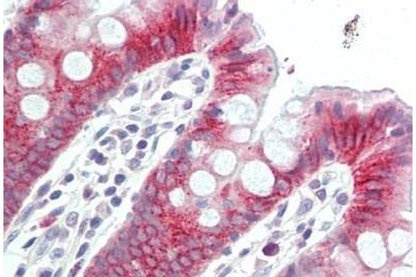 TOX antibody  (N-Term)