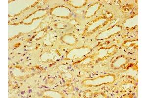Immunohistochemistry of paraffin-embedded human kidney tissue using ABIN7146703 at dilution of 1:100 (CA12 antibody  (AA 25-301))