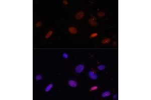 Immunofluorescence analysis of U-2 OS cells using Histone H1. (Histone H1 antibody  (AA 1-194))