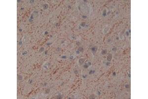 Used in DAB staining on fromalin fixed paraffin- embedded brain tissue (NT5M antibody  (AA 38-228))