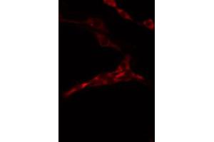 ABIN6274480 staining 293 by IF/ICC. (LMTK3 antibody)