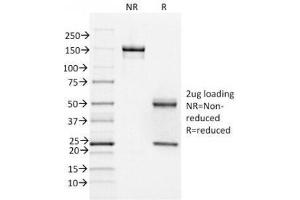 SDS-PAGE Analysis of Purified, BSA-Free FOXA1 Antibody (clone FOXA1/1518). (FOXA1 antibody  (AA 372-472))
